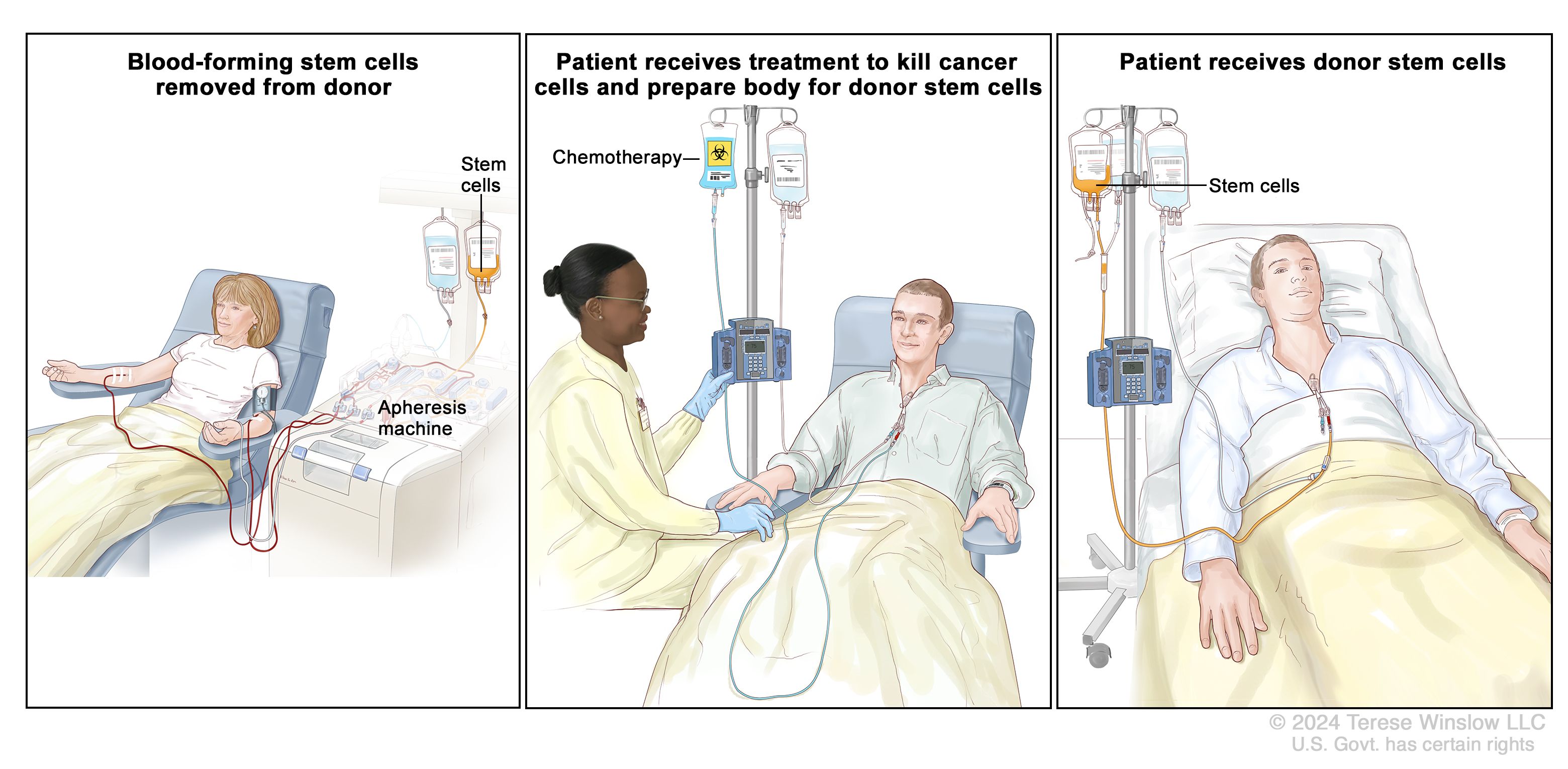 Chemotherapy 
